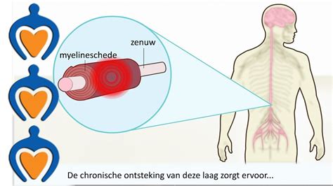 ms en seksualiteit|Multiple sclerose